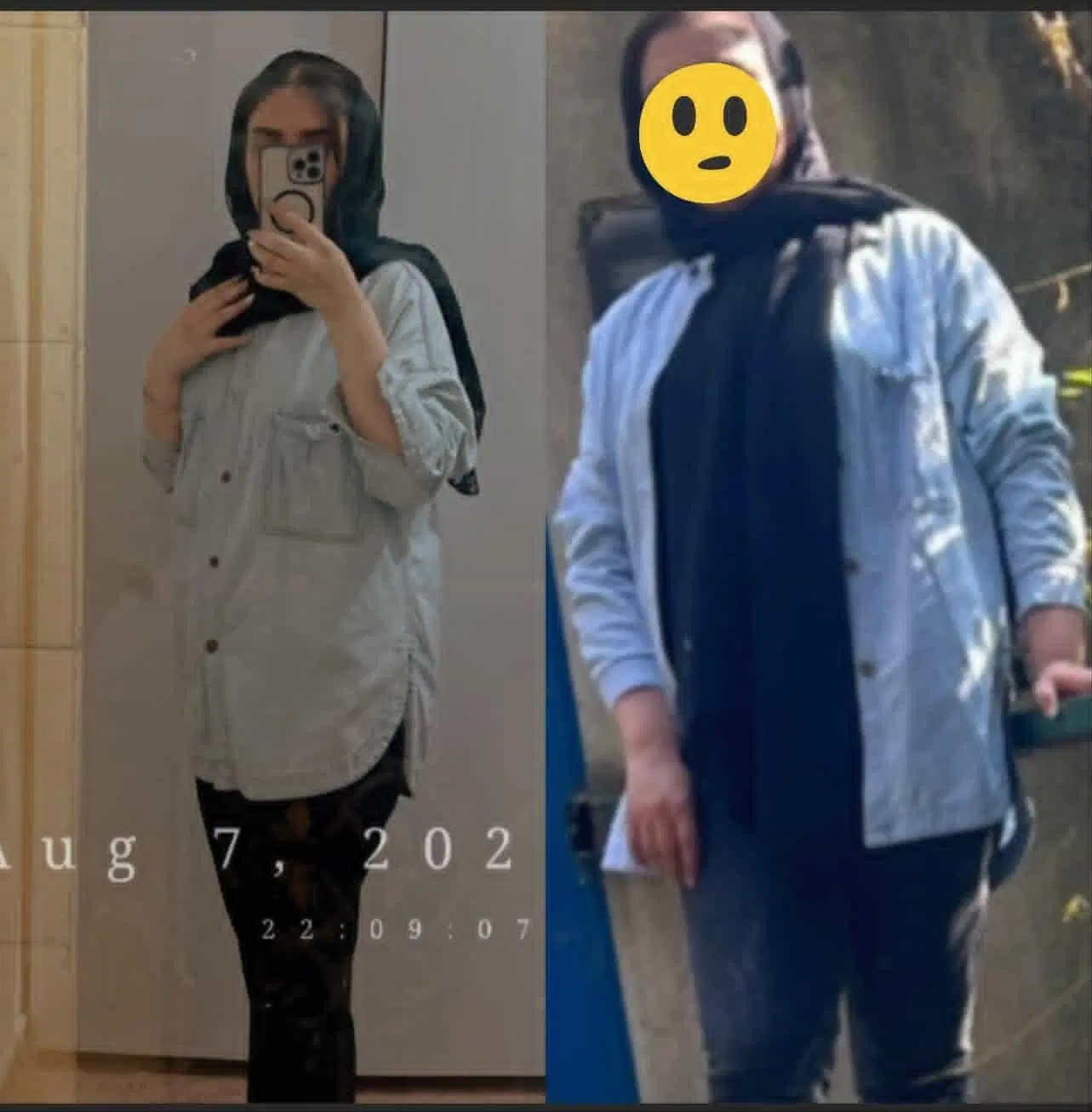 بزرگترین مرکز بوتاکس معده،لاغری وکاهش وزن تا۵۰کیلو|خدمات زیبایی و سلامت|تهران, دریا|دیوار