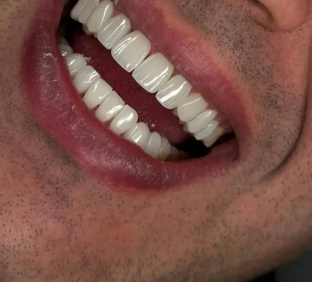 جشنواره پاییزه کامپوزیت شروع شد|خدمات آرایشگری و زیبایی|رباطکریم, رباطکریم|دیوار