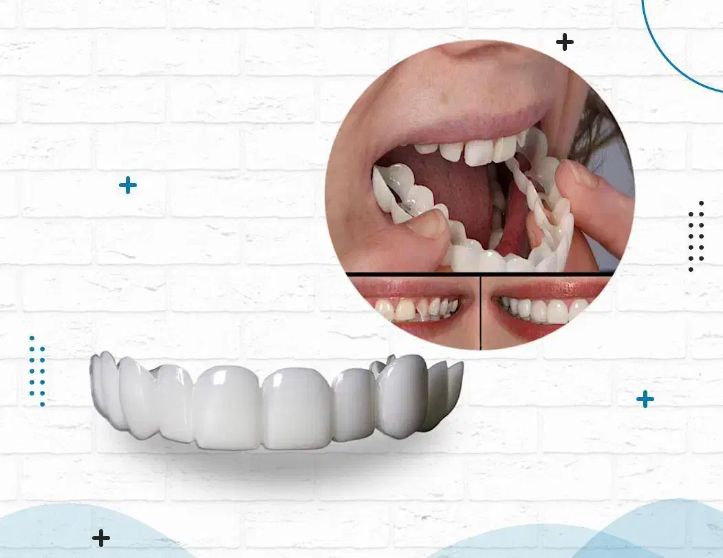 لمینت دندان دوفک|آرایشی، بهداشتی، درمانی|بیضا, |دیوار