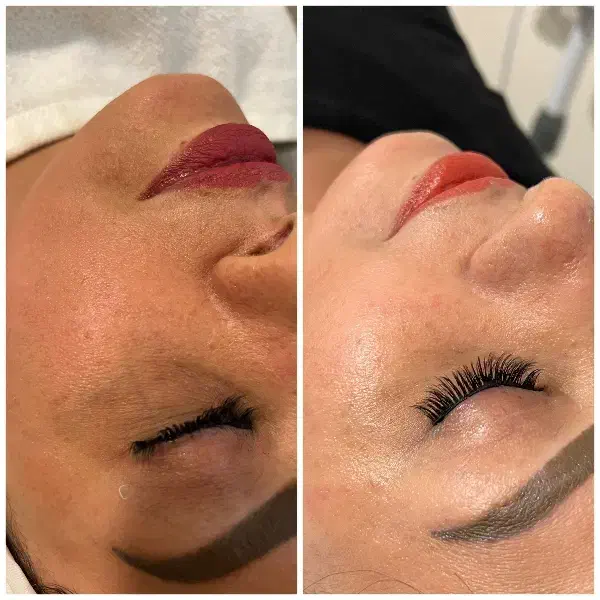 فشیال تخصصی+درماپلینگ+ اصلاح ابرو|خدمات آرایشگری و زیبایی|زاهدان, |دیوار