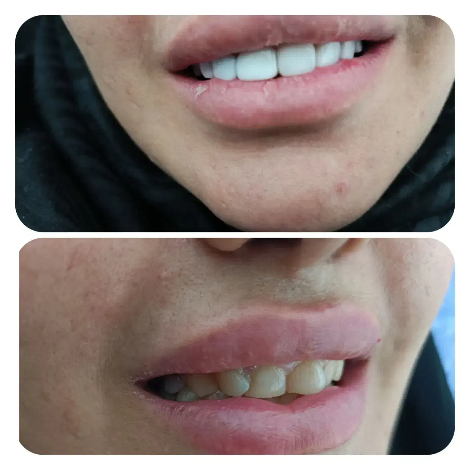 کامپوزیت ونیر|خدمات آرایشگری و زیبایی|اهواز, کوی طلاب|دیوار