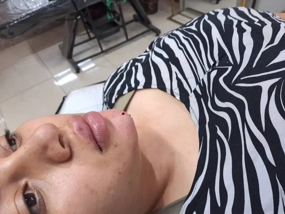 تزریق فیلر و بوتاکس با ماندگاری و نتیجه طبیعی|خدمات آرایشگری و زیبایی|تهران, مهرآباد|دیوار