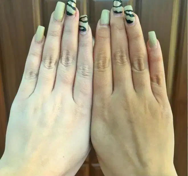 کرم سفید کننده ضدلک وضدجوش اصل سورو|آرایشی، بهداشتی، درمانی|بندرعباس, |دیوار