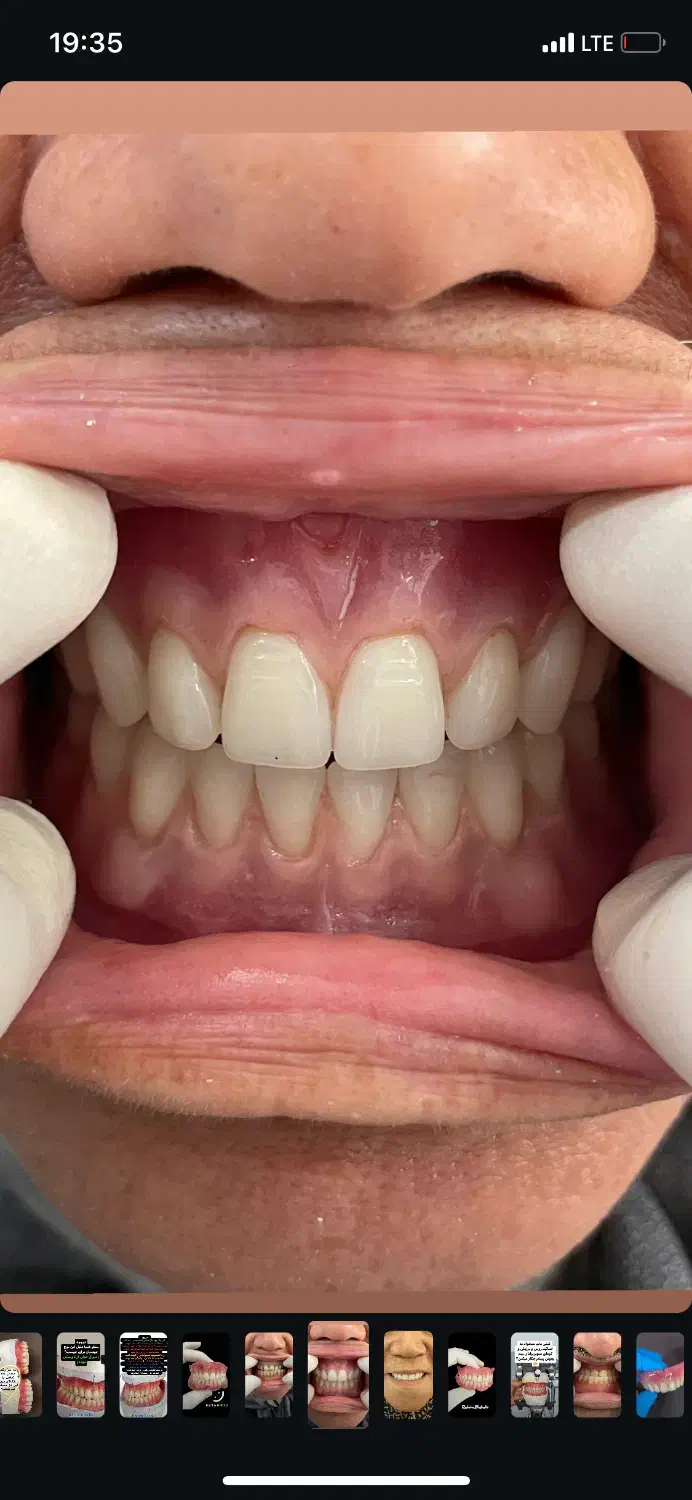 کلینیک دندانسازی|آرایشی، بهداشتی، درمانی|آمل, |دیوار