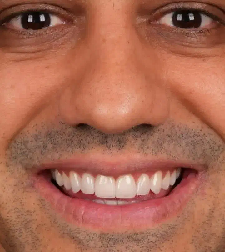 دندان های مرواریدی داشته باشید|پزشکی|اراک, |دیوار