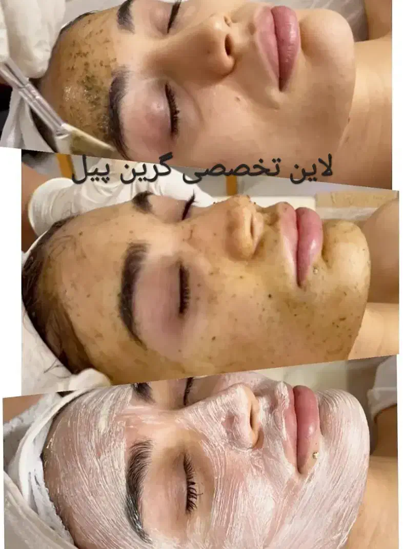 خدمات فیشیال حرفه ای و تراپی های تخصصی پوست|خدمات آرایشگری و زیبایی|تهران, تهرانسر شمالی|دیوار