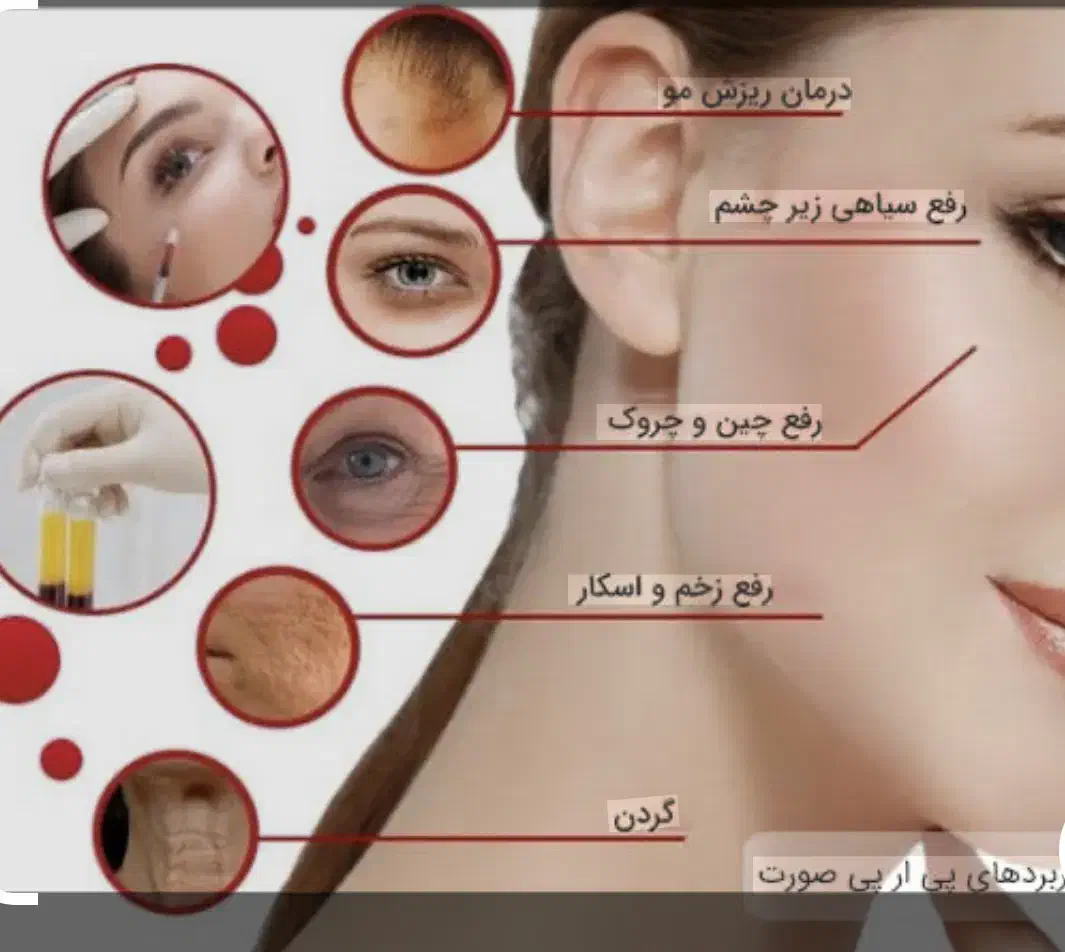 Prp|خدمات آرایشگری و زیبایی|بهبهان, |دیوار