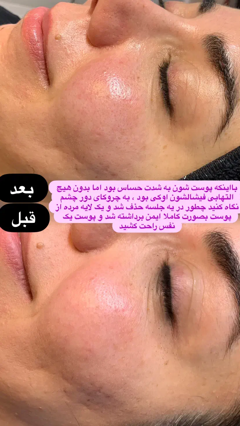 خدمات باورنکردنی|خدمات آرایشگری و زیبایی|مشهد, ابوذر|دیوار