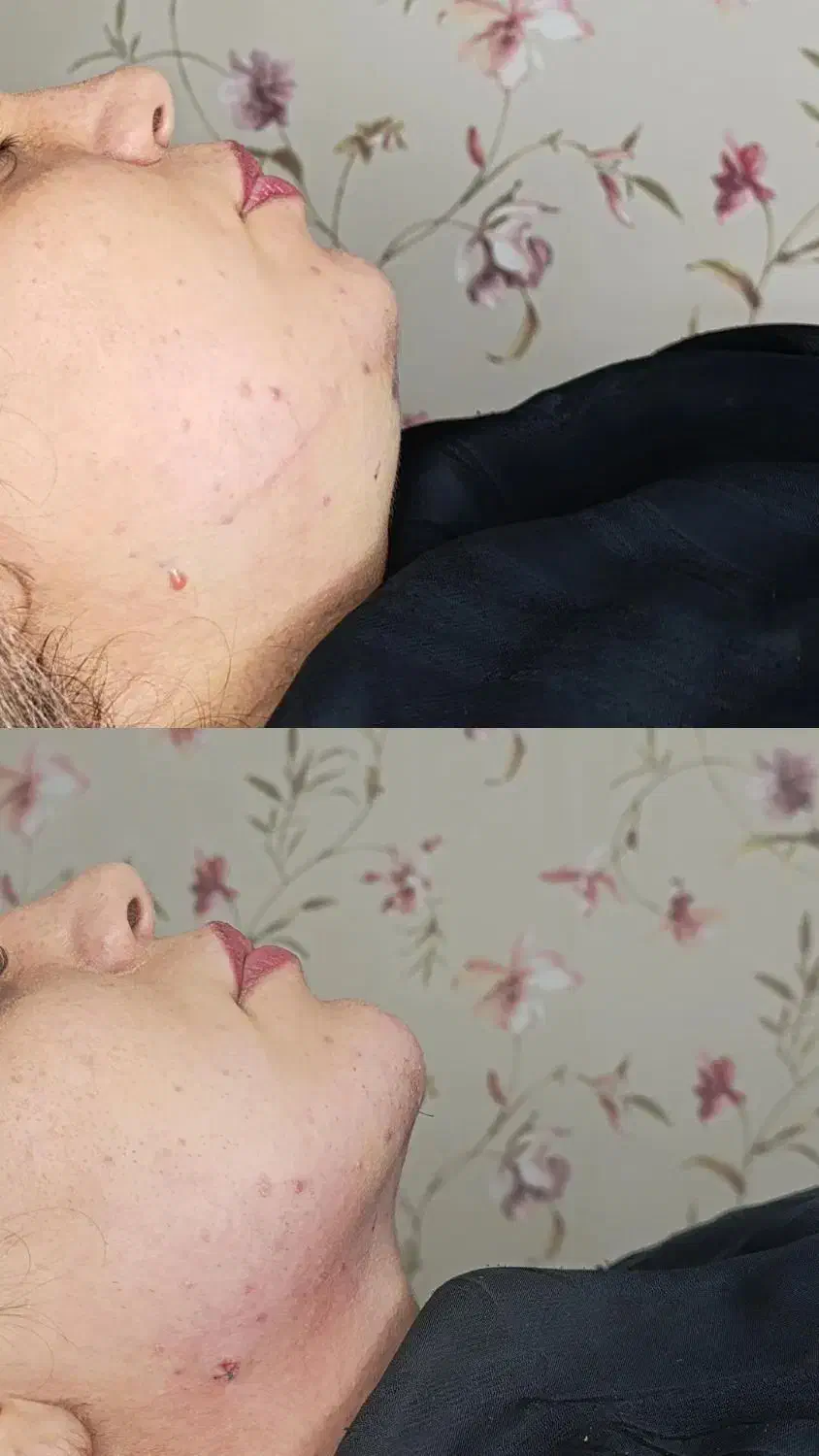 کیلینک زیبایی پاستور تخصصی ترین کیلینک زنجان|خدمات آرایشگری و زیبایی|زنجان, |دیوار