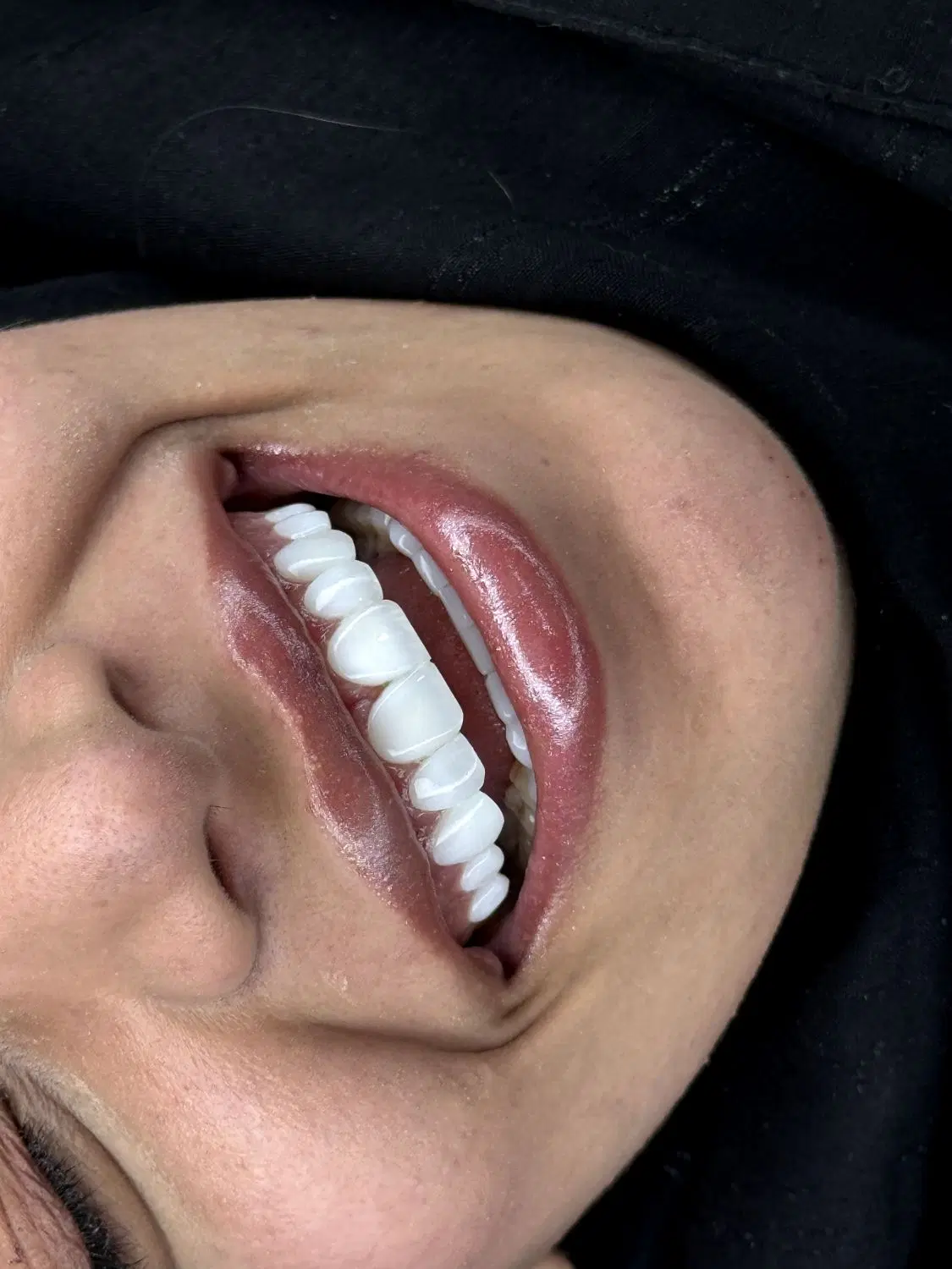 جشنواره باورنکردنی افتتاحیه دندانپزشکی قائم(۷تیر)|خدمات زیبایی و سلامت|مشهد, هفت تیر (حافظ)|دیوار