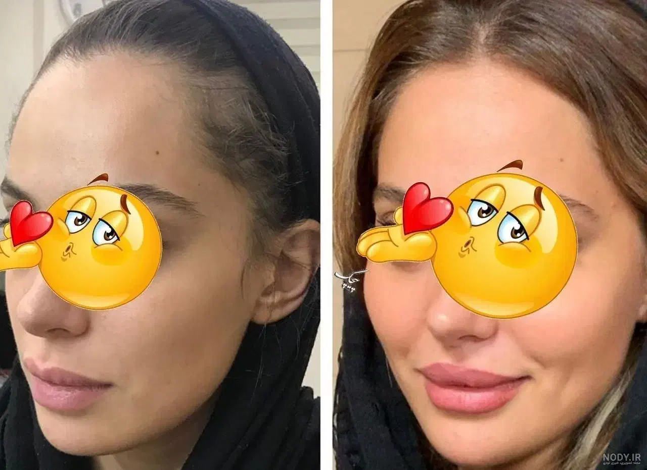 چاقی صورت تپلی صورت دائمی جوانه گندم|خوردنی و آشامیدنی|ماهان, |دیوار