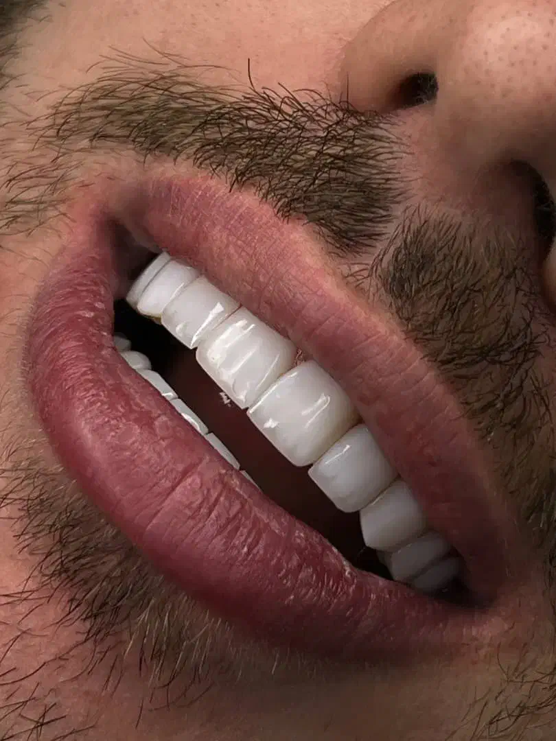 خدمات زیبایی دندان|خدمات آرایشگری و زیبایی|تهران, ولنجک|دیوار