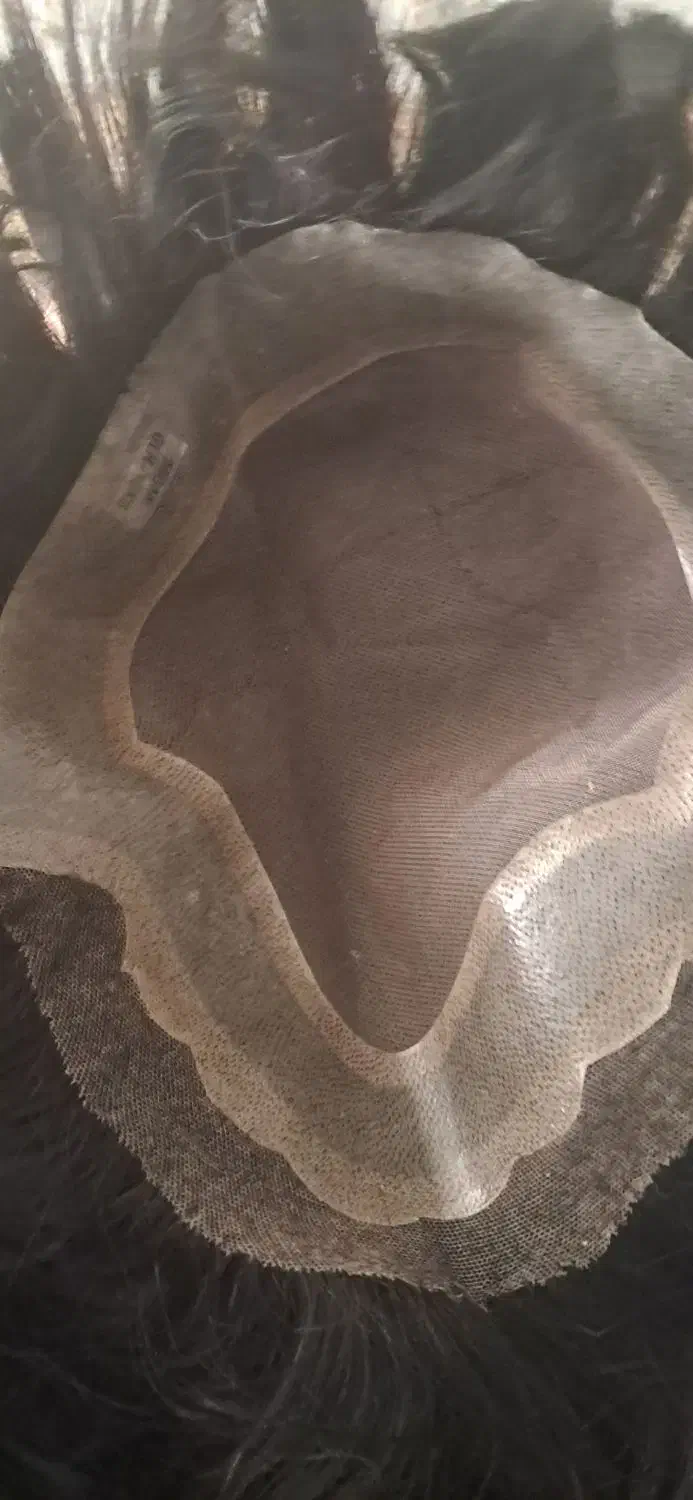 پروتز مو|آرایشی، بهداشتی، درمانی|کرمانشاه, |دیوار