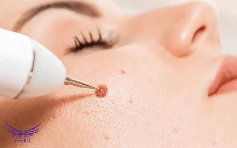 خالبرداری|خدمات آرایشگری و زیبایی|تربت جام, یحیی آباد|دیوار