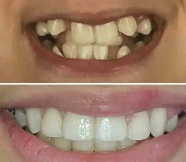 ارتودنسی|خدمات آرایشگری و زیبایی|فولادشهر, B2|دیوار