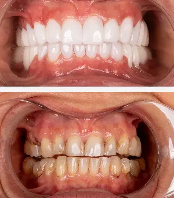 شرایط ویژه کامپوزیت دندان|خدمات آرایشگری و زیبایی|آذرشهر, |دیوار