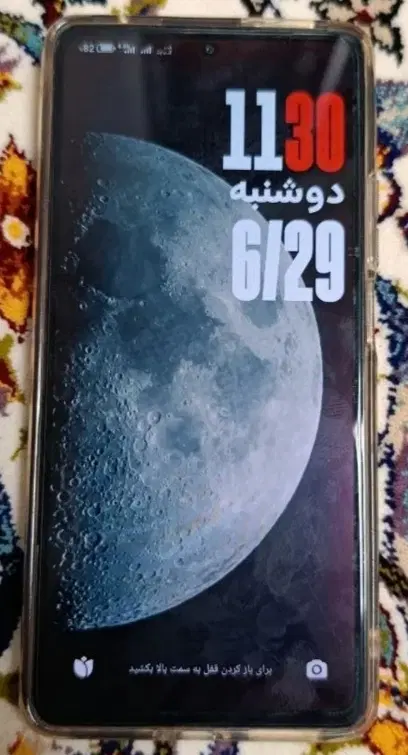 شیامی نت 11 در حد نو|موبایل|کرمانشاه, |دیوار
