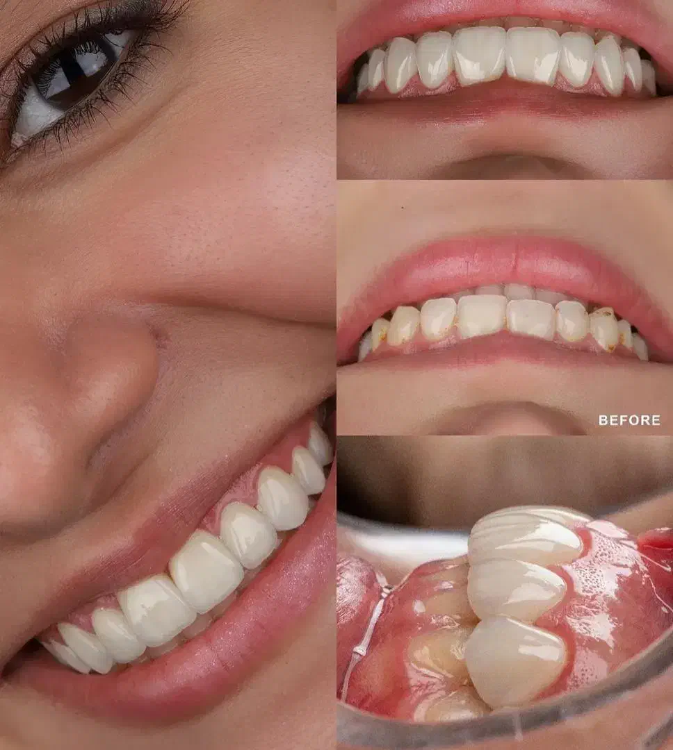 دندانپزشکی به صورت رایگان توسط متخصص عصب کشی ،ارتو|خدمات آرایشگری و زیبایی|تهران, تجریش|دیوار