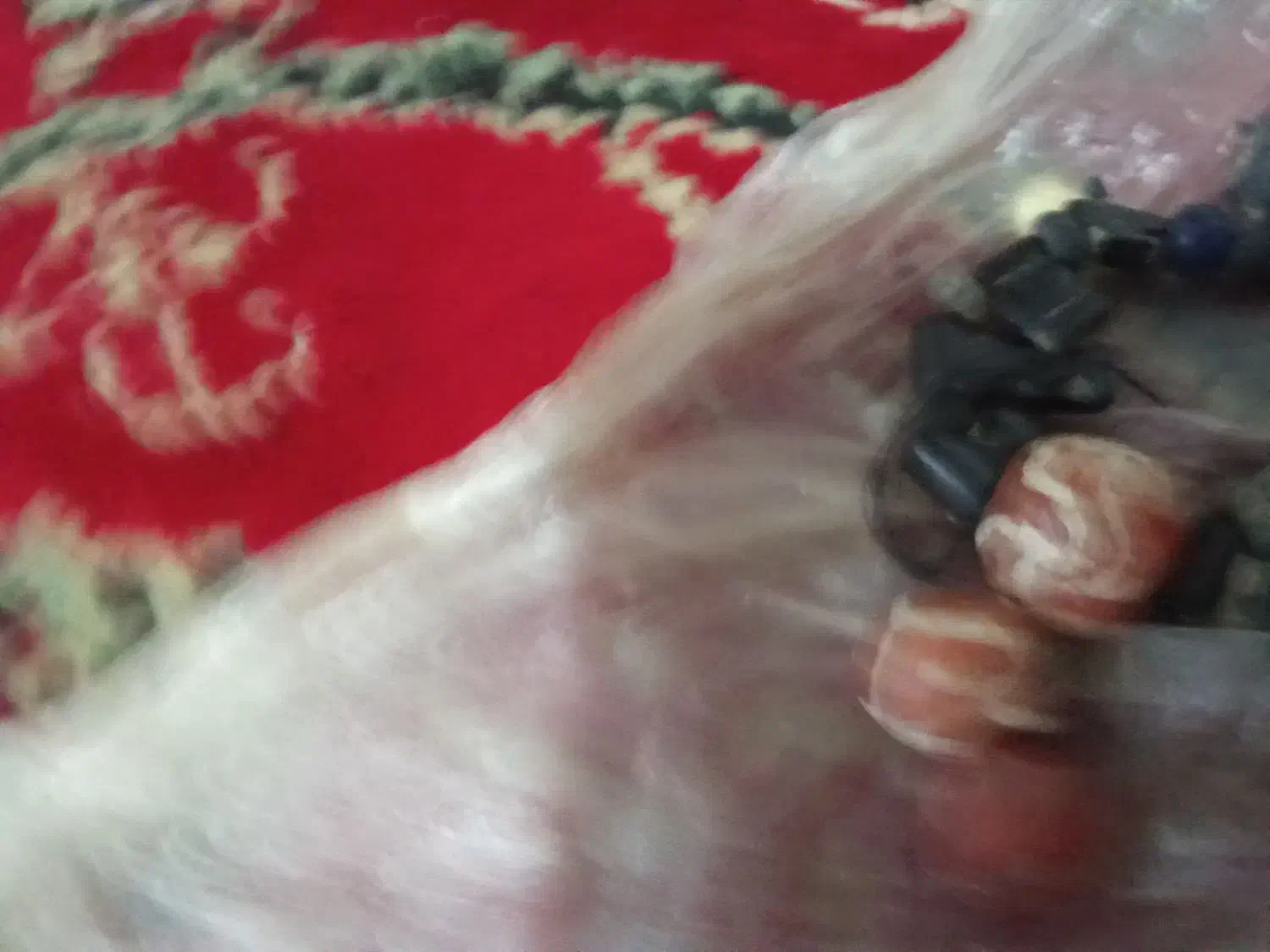 مهره کهنه پیازی|کلکسیون اشیاء عتیقه|سیاهکل, |دیوار