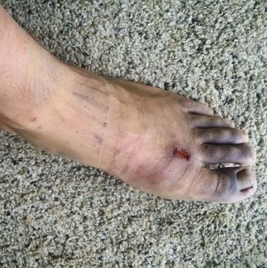 بهبودی کامل دیابت|آرایشی، بهداشتی، درمانی|گنبد کاووس, |دیوار