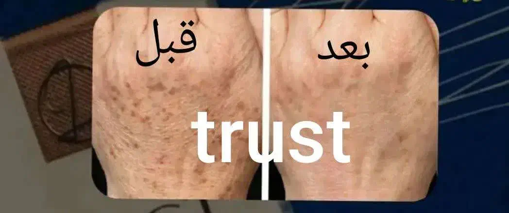 مشاوره پوست ومو|آرایشی، بهداشتی، درمانی|محمدیه-قزوین, |دیوار