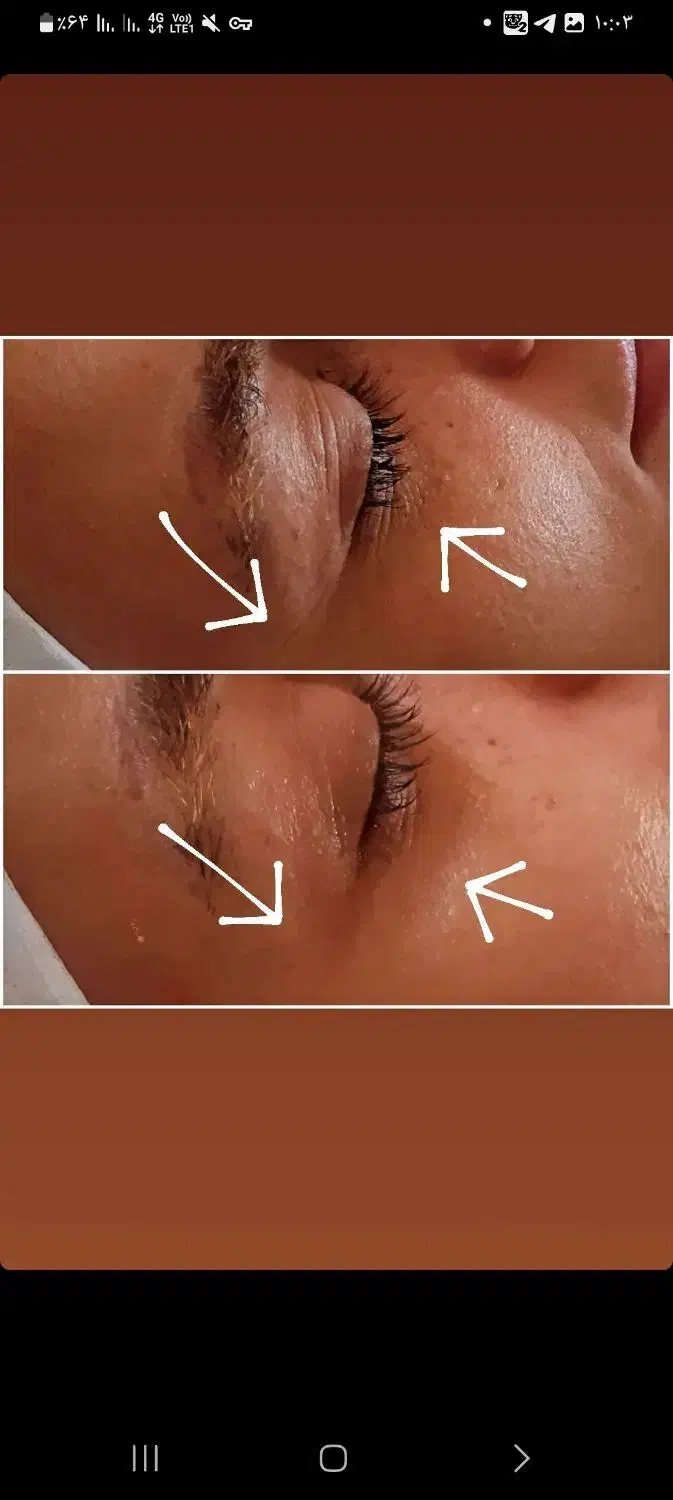 پاکسازی وآبرسانی پوست باتخفیف|خدمات آرایشگری و زیبایی|مرند, |دیوار