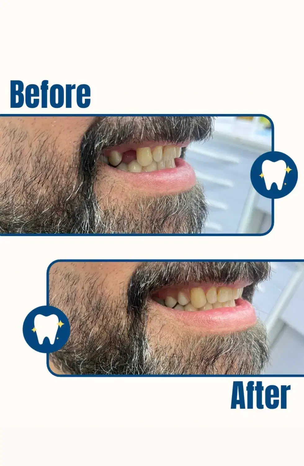 دندان مصنوعی اقساط و بیمه|خدمات آرایشگری و زیبایی|کرمان, |دیوار