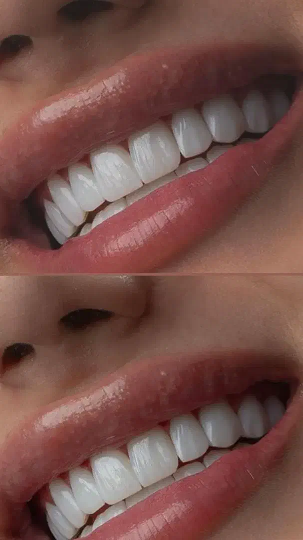 خدمات تخصصی زیبایی دندان|خدمات آرایشگری و زیبایی|بندر کنگان, |دیوار