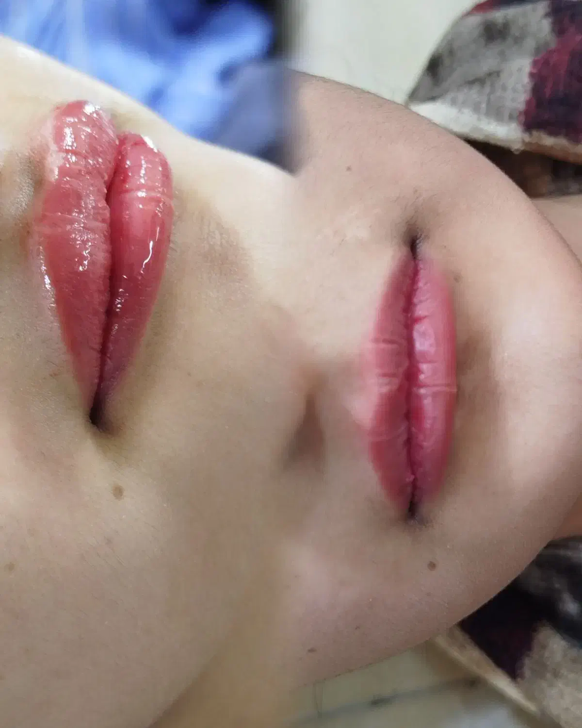 فیشال صورت ،درمان مو ،تزریق ژل صورت|خدمات آرایشگری و زیبایی|کارون, |دیوار