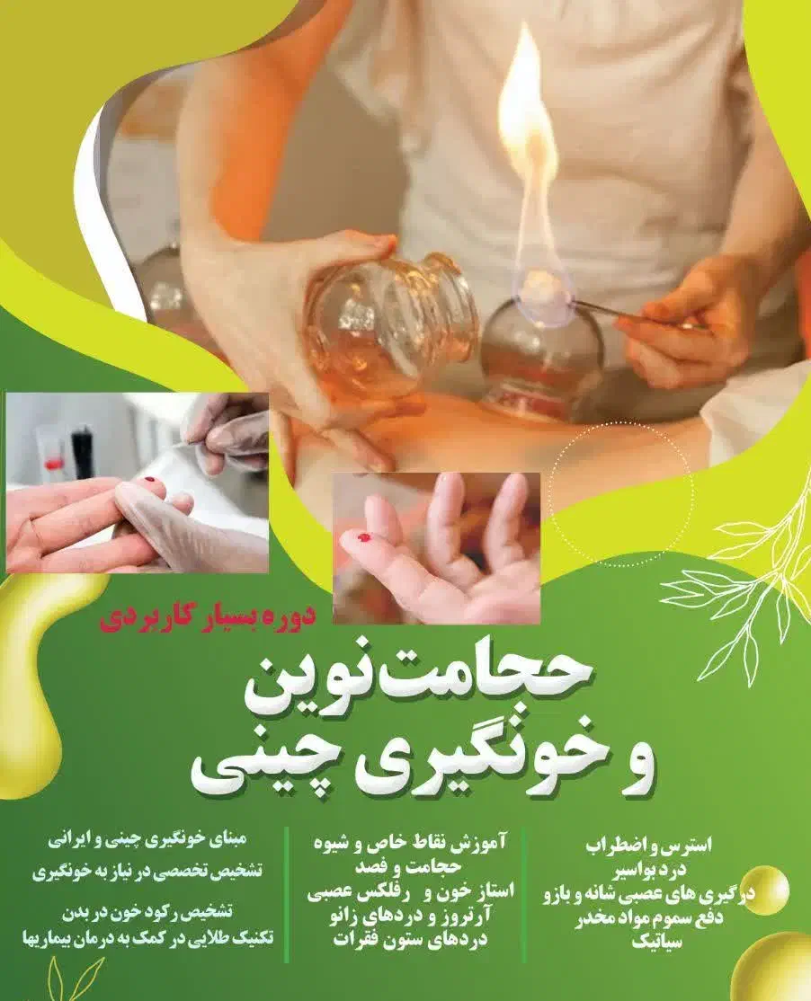 آموزش حجامت نوین و فصد چینی|خدمات آموزشی|اراک, |دیوار