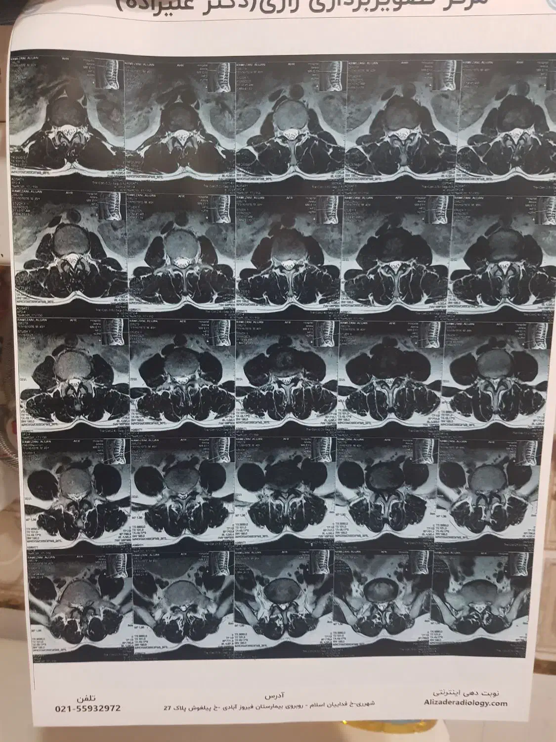 بی حسی پا|فعالیت داوطلبانه|قرچک, مهدیه|دیوار