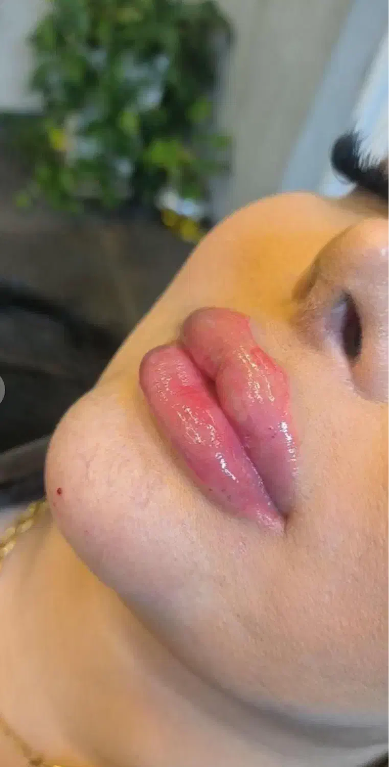 تزریق انواع فیلر (ژل )بوتاکس وخدمات میکروپیگمنتیشن|خدمات آرایشگری و زیبایی|یاسوج, |دیوار