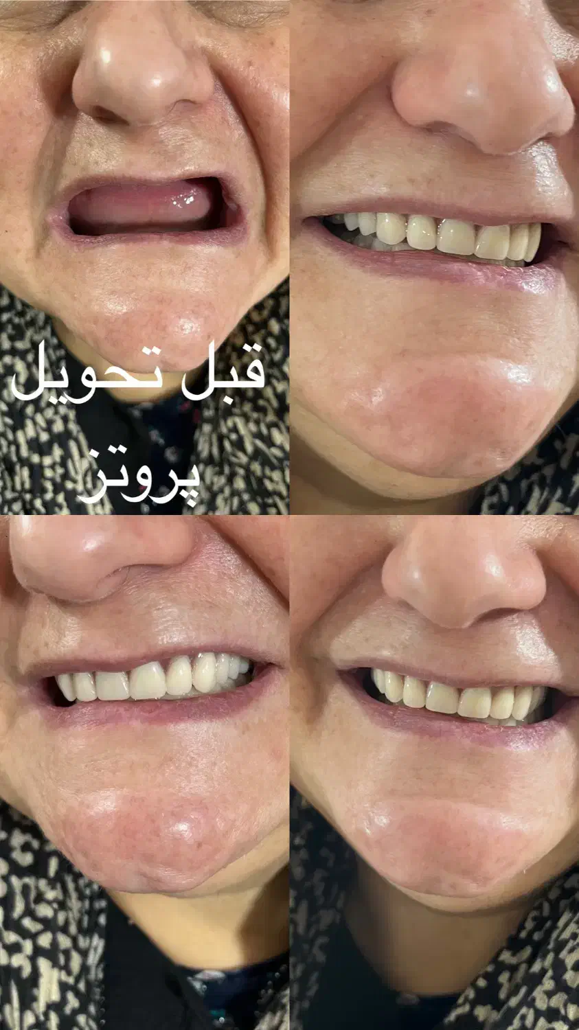 دندان مصنوعی|خدمات آرایشگری و زیبایی|پرند, فاز ۲|دیوار