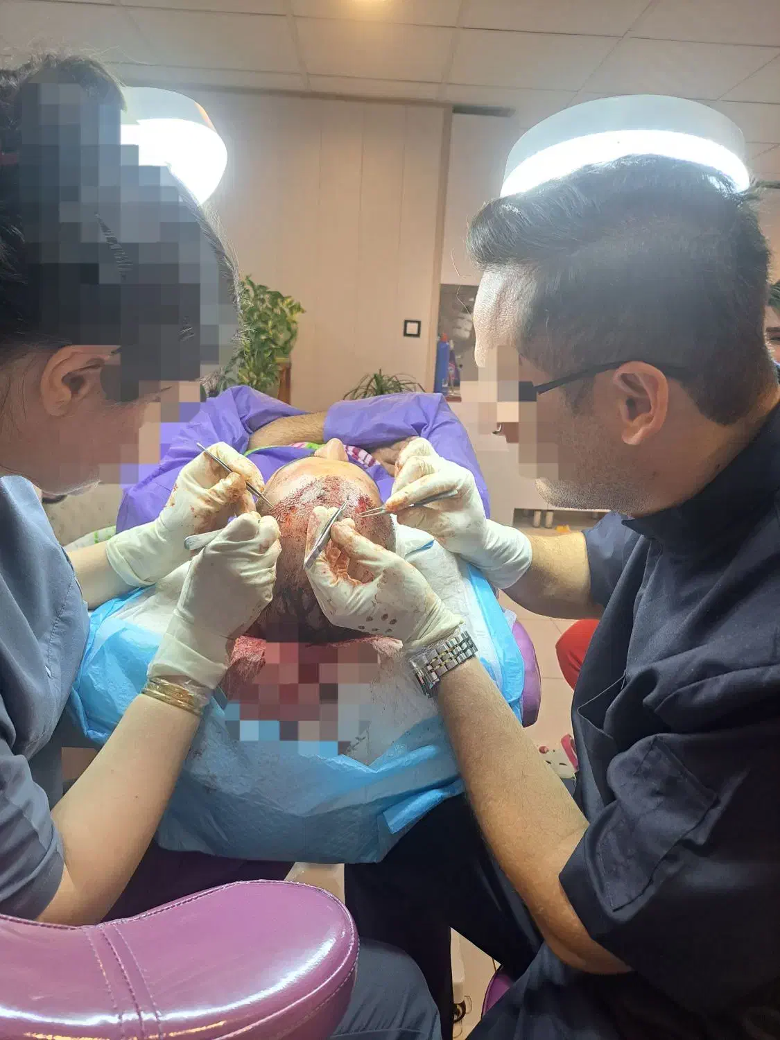 آموزش کاشت مو ابرو صفرتاصد شیراز مدرک معتبر|خدمات آموزشی|شیراز, چوگیاه‎|دیوار