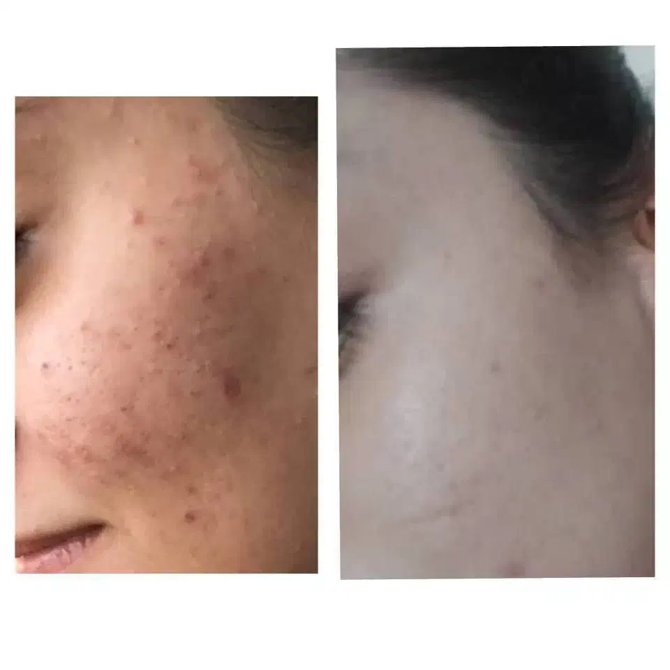 پوست هلویی زیبا بدون تزریق|آرایشی، بهداشتی، درمانی|اراک, |دیوار