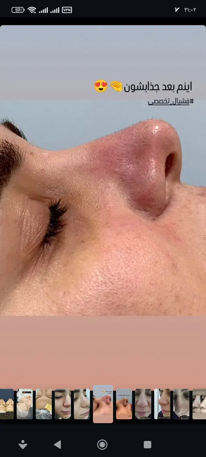 فشیال تخصصی با بهترین برند اکلدو|خدمات آرایشگری و زیبایی|برازجان, |دیوار