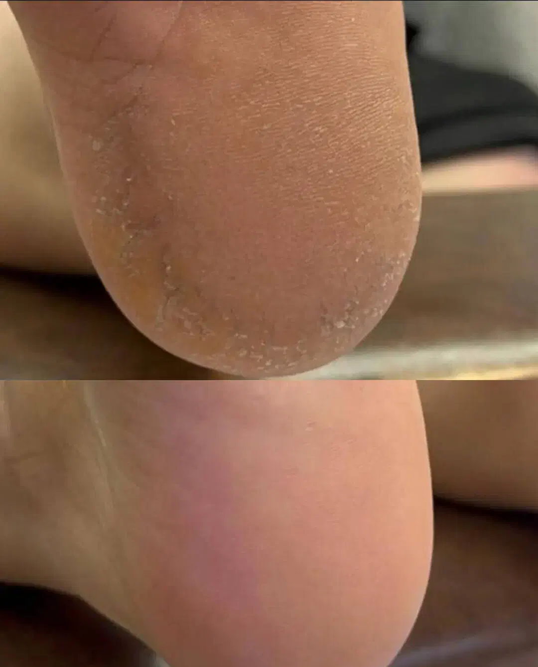 پدیکور|خدمات آرایشگری و زیبایی|ایذه, |دیوار