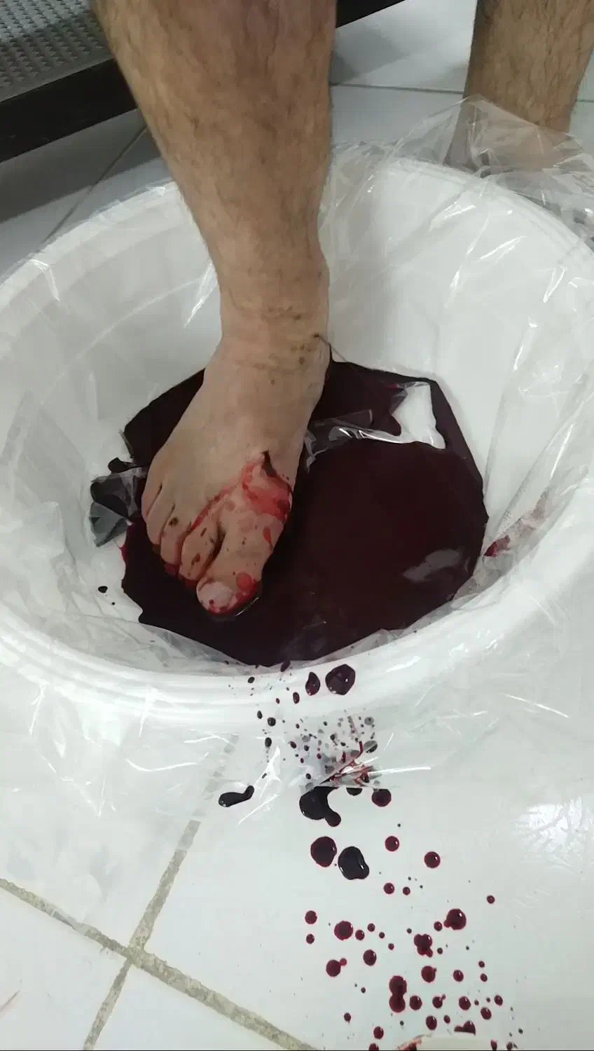 حجامت. فصد. زالو درمانی.|خدمات آرایشگری و زیبایی|مشهد, شاهد (شهرک غرب)|دیوار