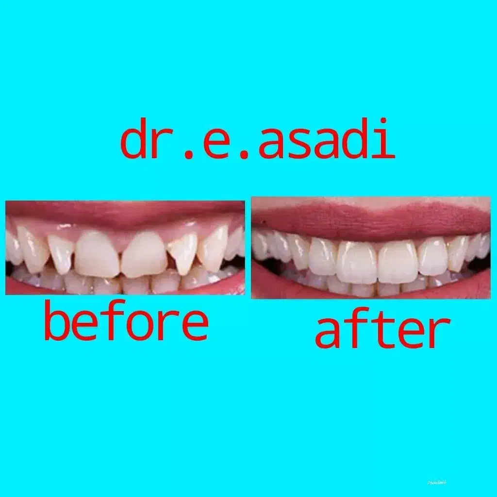 دندانپزشکی و زیبایی لبخند، تعرفه دولتی|خدمات آرایشگری و زیبایی|تهران, جمالزاده|دیوار