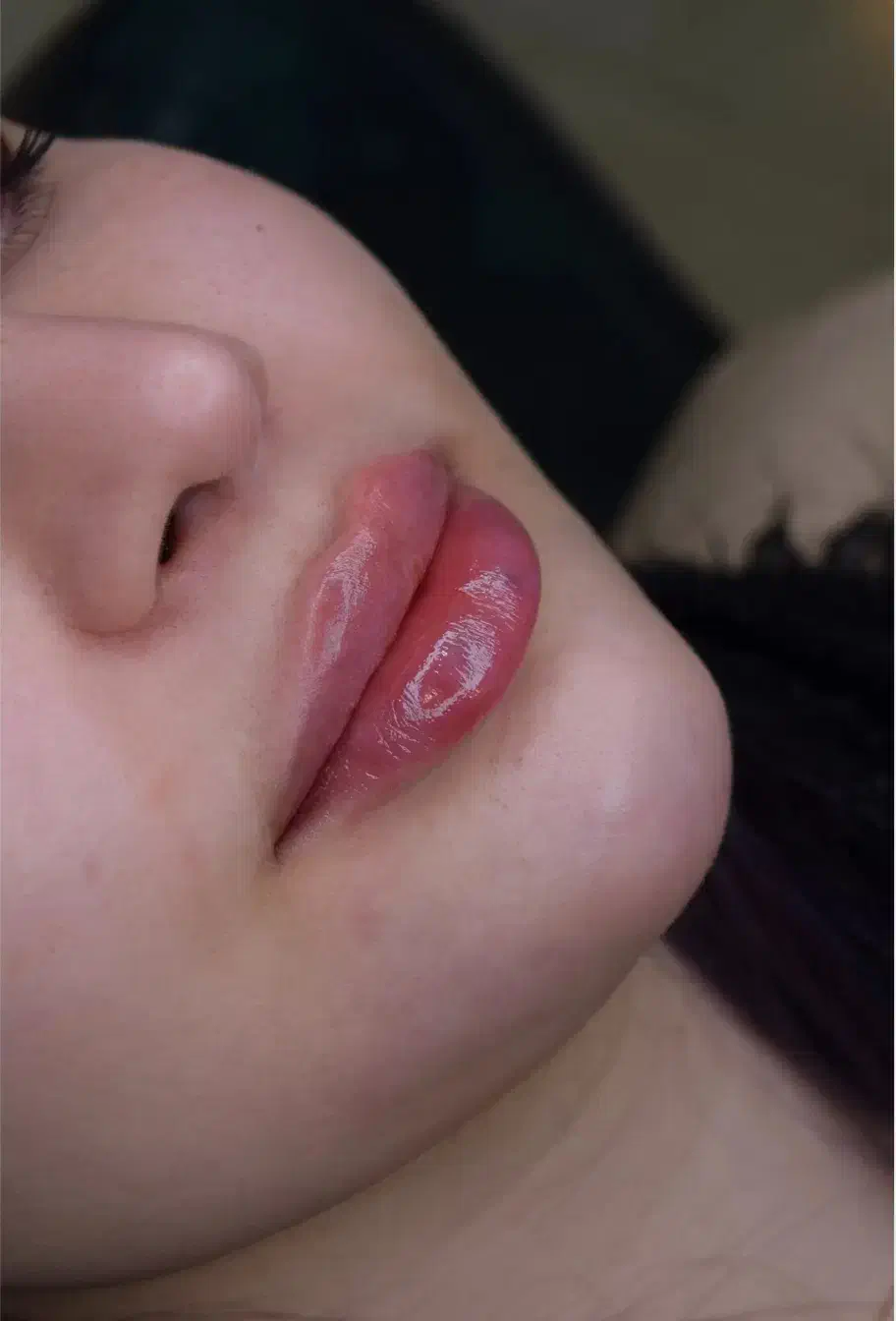 خدمات زیبایی تزریق فیلر ،بوتاکس و لیزر در مطب پزشک|خدمات آرایشگری و زیبایی|قم, نیروگاه|دیوار