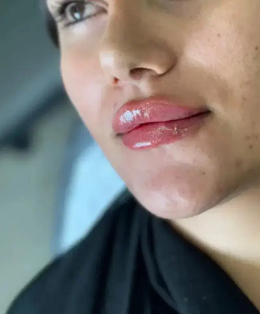 ژل لب|خدمات آرایشگری و زیبایی|اسلامشهر, شهرک مهدیه|دیوار