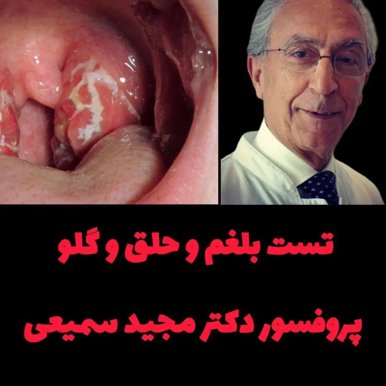 رفع بلغم وخلط پشت گلو|فعالیت داوطلبانه|قم, امامزاده ابراهیم|دیوار