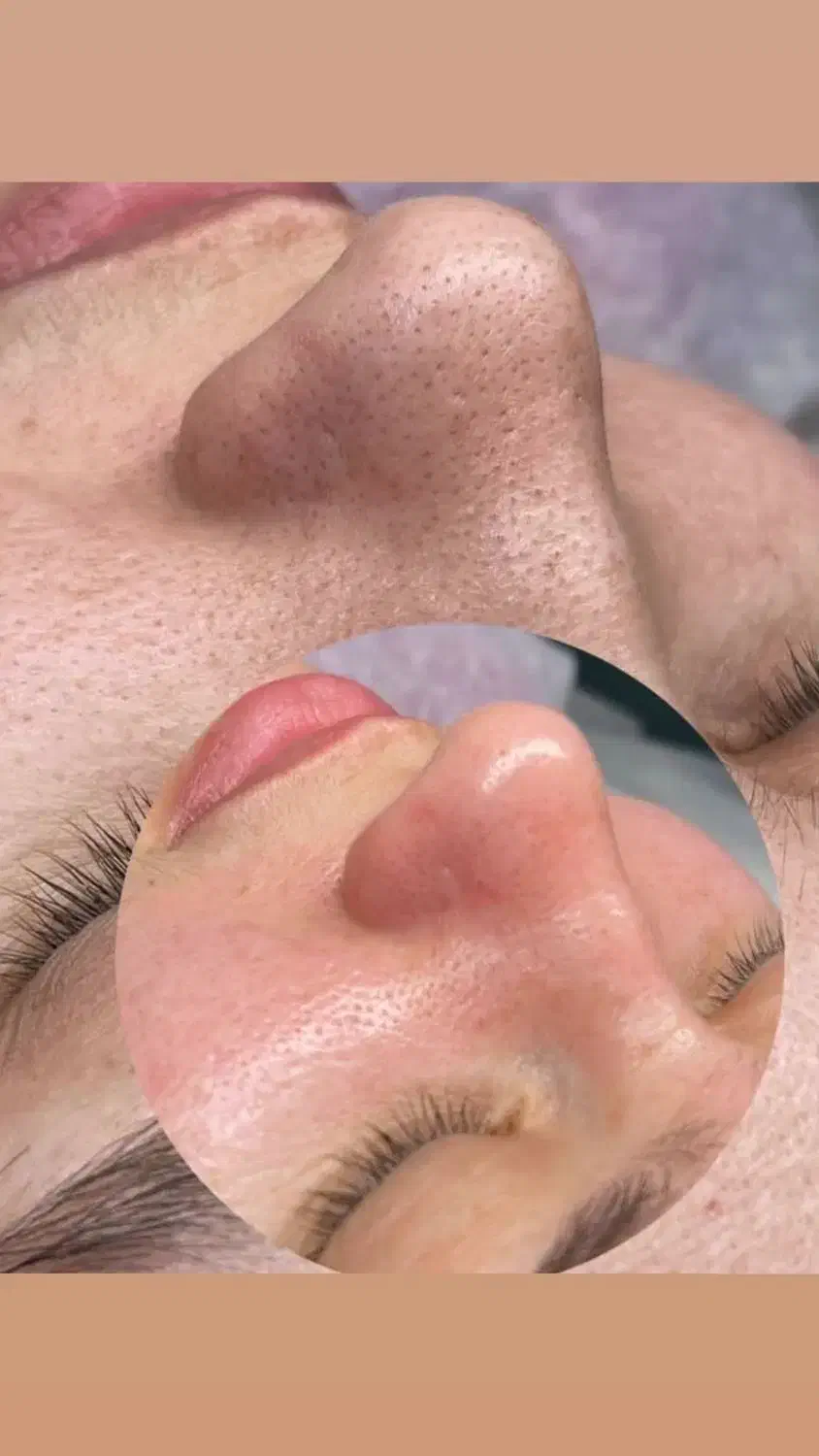 اموزش فیشیال|خدمات آموزشی|تهران, خلیج فارس|دیوار