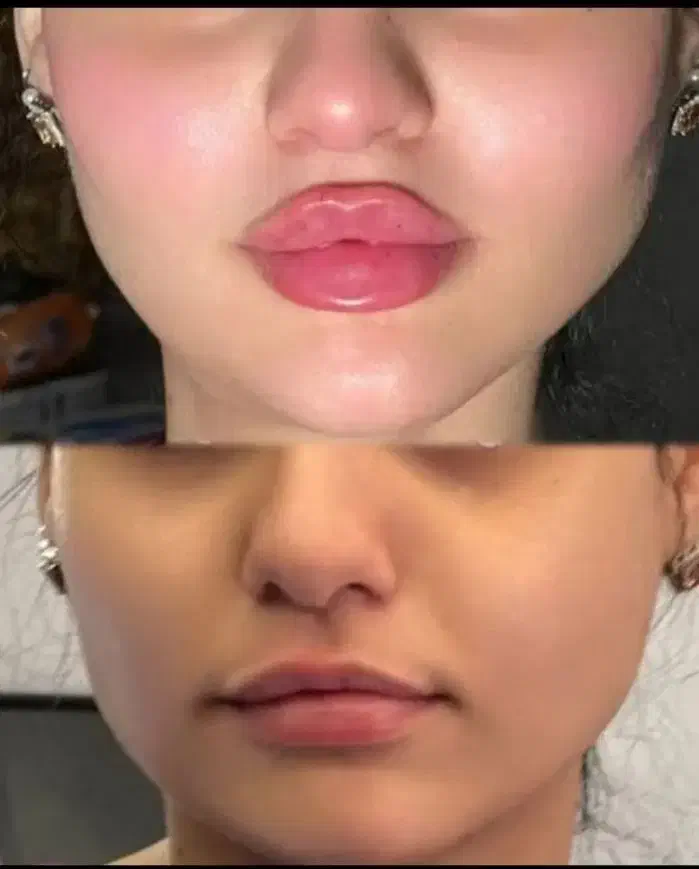 آف تزریق ژل وبوتاکس ومزومووصورت|خدمات آرایشگری و زیبایی|اهواز, نادری|دیوار