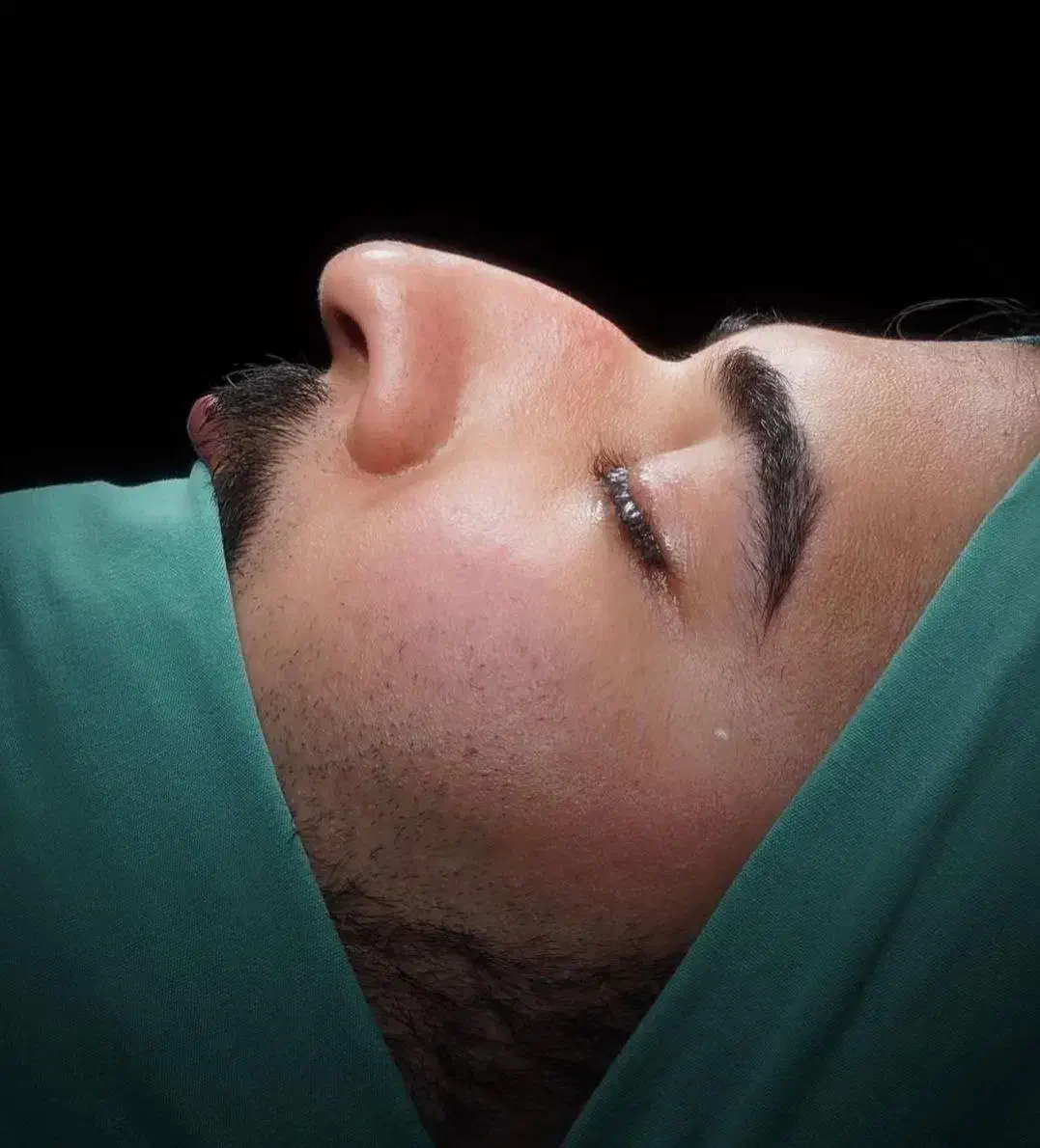 عمل بینی متخصص گوش حلق بینی، اقساطی|خدمات آرایشگری و زیبایی|تهران, قلهک|دیوار