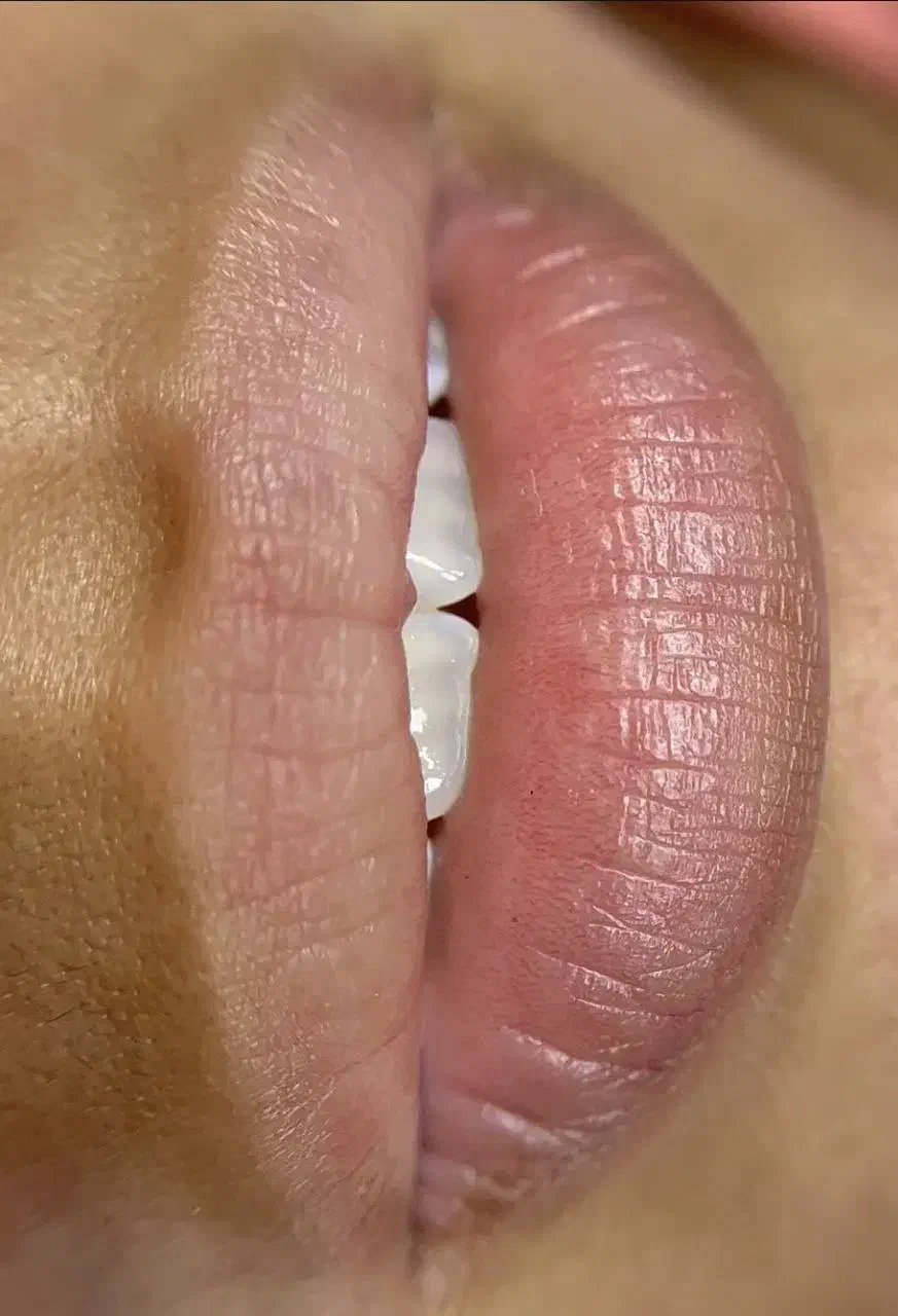 تخفیف تا پایان هفته شیدلب|خدمات آرایشگری و زیبایی|بوشهر, |دیوار