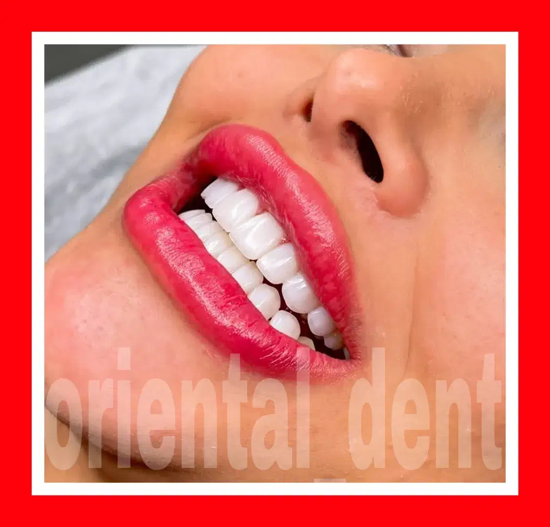 بریج و کامپوزیت و لیفت لثه جرمگیری دندان عصبکشی|خدمات آرایشگری و زیبایی|تهران, تهرانپارس غربی|دیوار