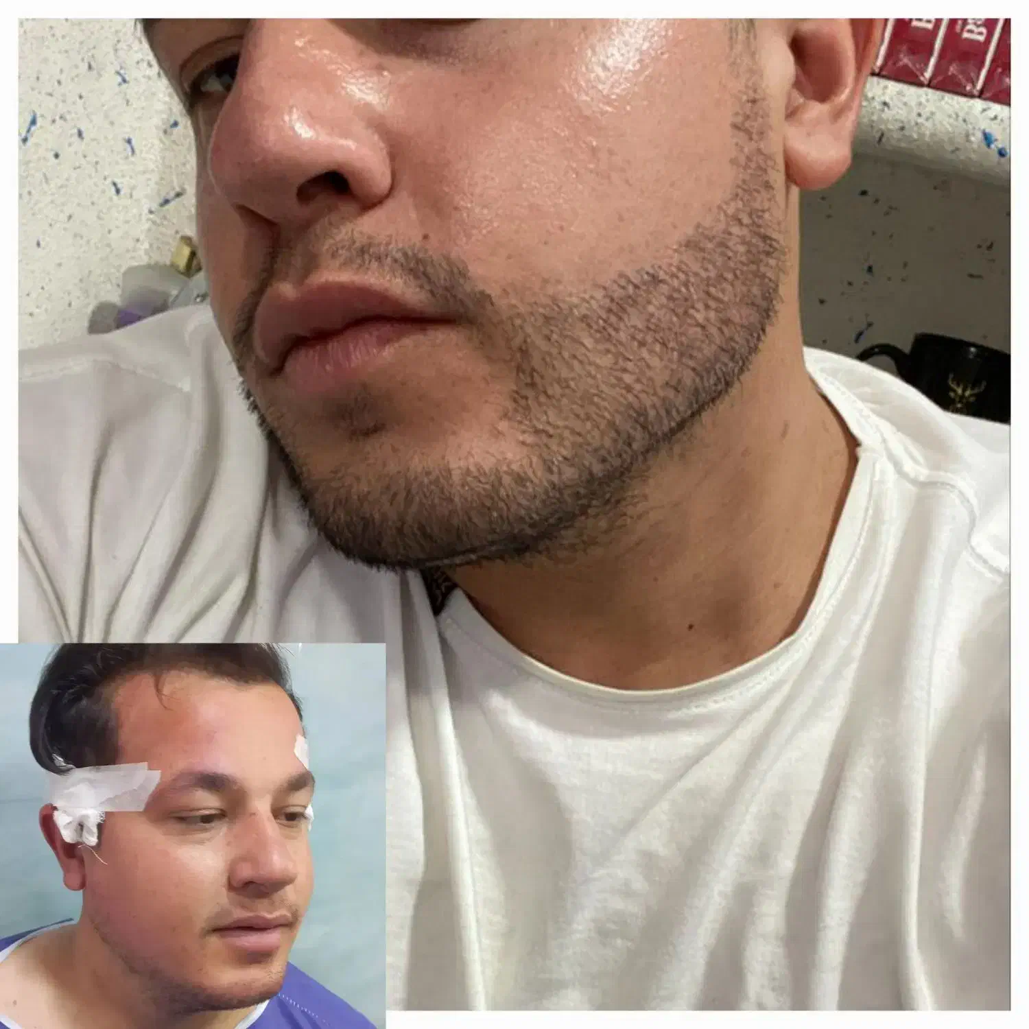 کاشت مو وابرو جشنواره ویژه|خدمات آرایشگری و زیبایی|یزد, |دیوار