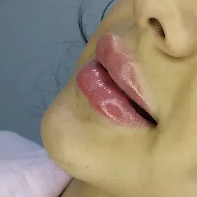 ژل ـ لب ـ گونه و... بوتاکس. آنزیم|خدمات آرایشگری و زیبایی|قم, تولید دارو و یخچال|دیوار