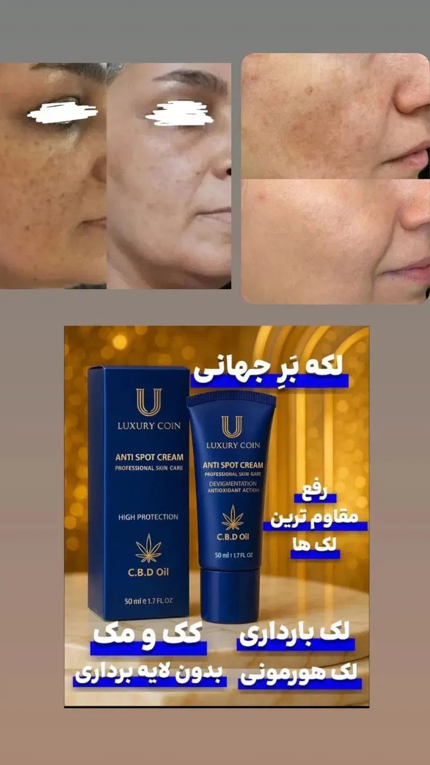 کرم ضدلک ۸کاره فرانسوی|آرایشی، بهداشتی، درمانی|لنگرود, |دیوار